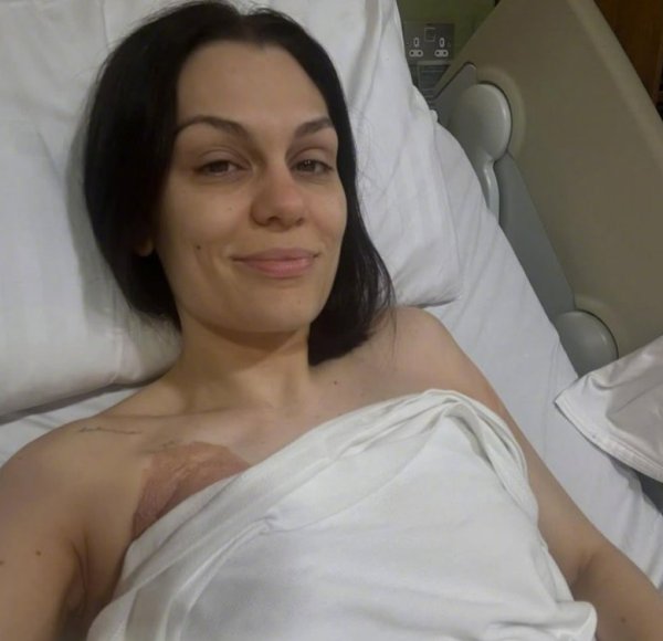 慧眼智行 知名歌手“结石姐”乳腺癌手术后将重返荧幕，参加《舞动奇迹》，曾在《歌手》夺冠